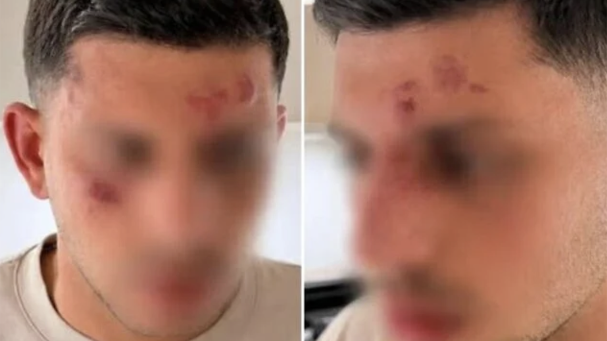 Il ragazzo ferito dopo l'aggressione a Londra perché parlava ebraico