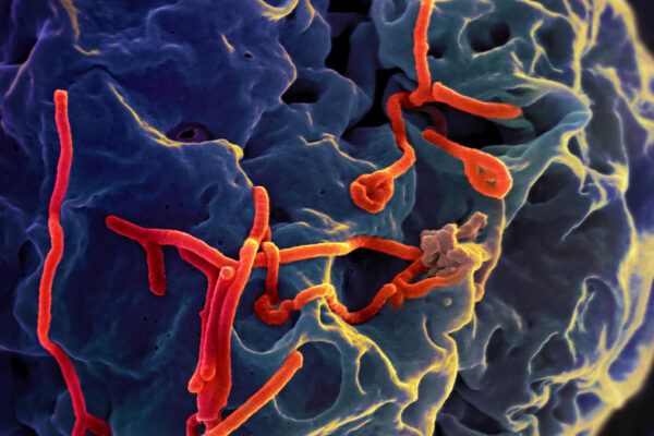 virus Ebola (foto WikimediaCommons)