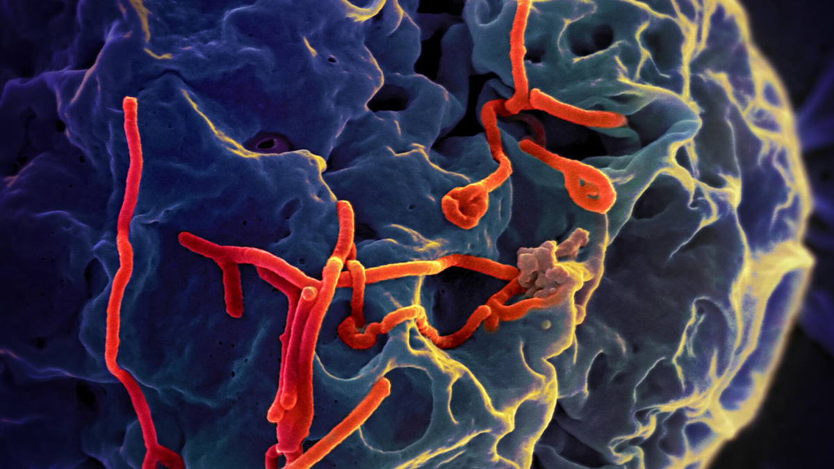 virus Ebola (foto WikimediaCommons)